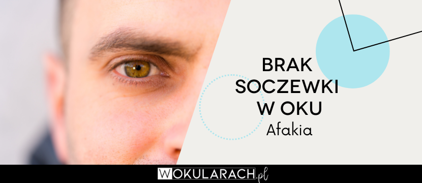 Brak soczewki w oku - afakia