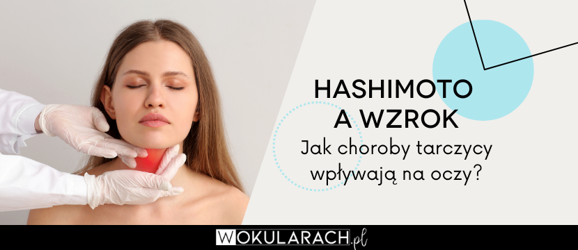 Hashimoto a wzrok. Jak choroby tarczycy wpływają na oczy?