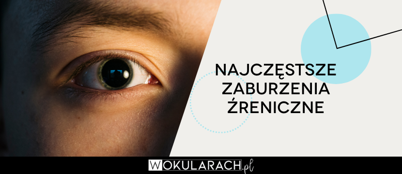 Najczęstsze zaburzenia źreniczne