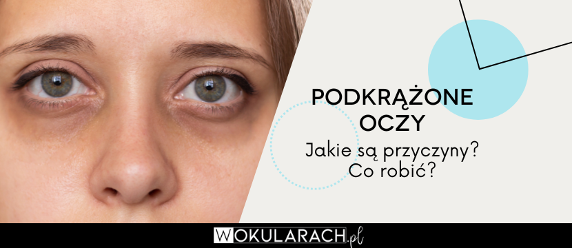 Podkrążone oczy - przyczyny i jak sobie radzić?