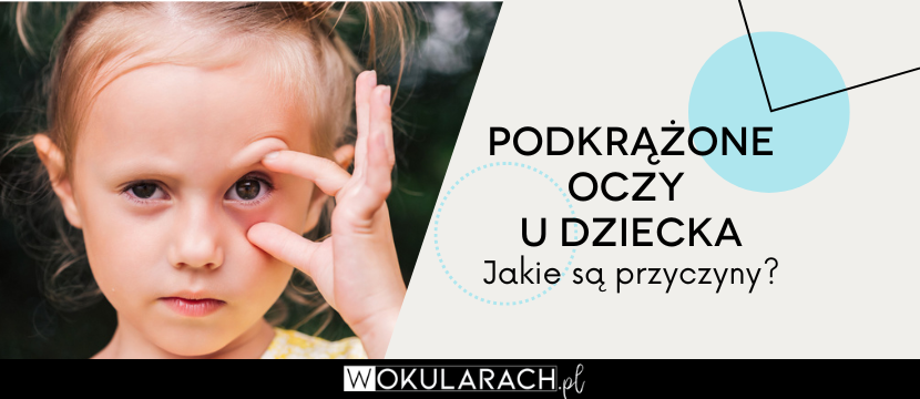 Podkrążone oczy u dziecka - jakie są przyczyny?