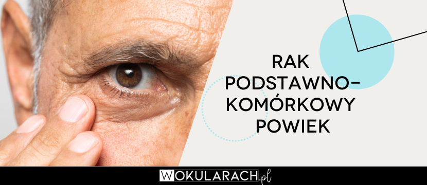 Rak podstawnokomórkowy powiek