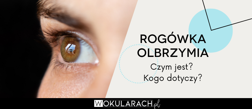 Rogówka olbrzymia – czym jest? Kogo dotyczy?