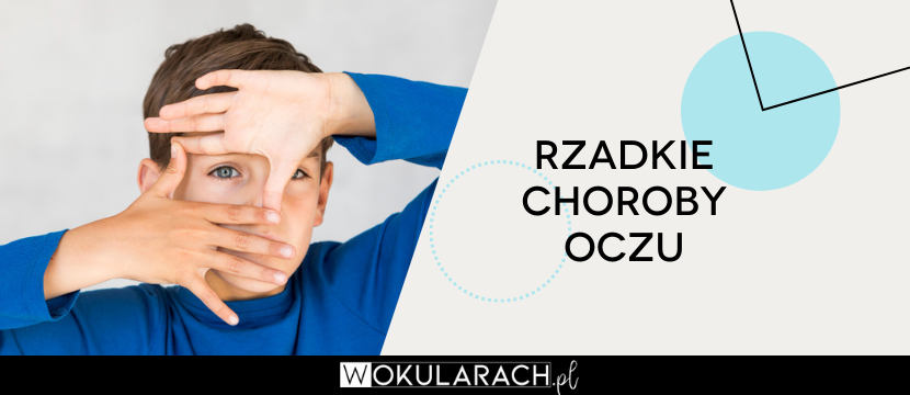 Rzadkie choroby oczu