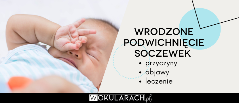 Wrodzone podwichnięcie soczewek – przyczyny, objawy i leczenie