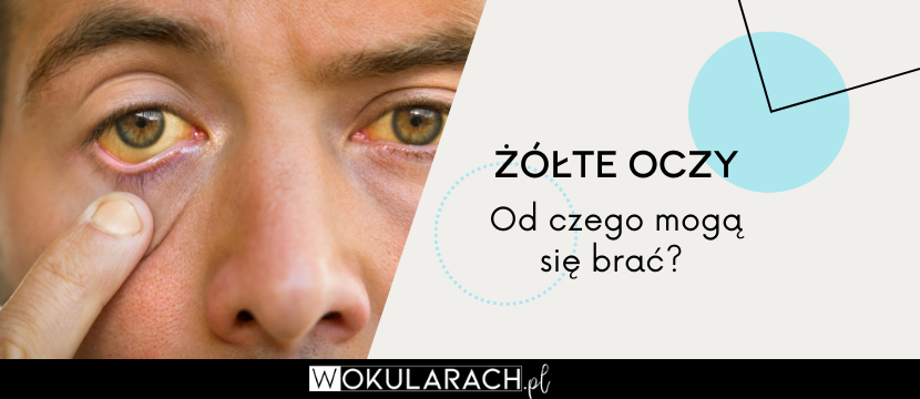 Żółte oczy – od czego mogą się brać?