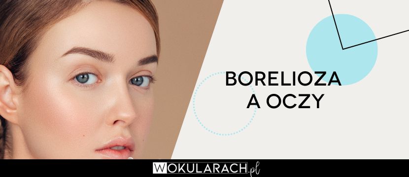 Borelioza a oczy – to warto wiedzieć!