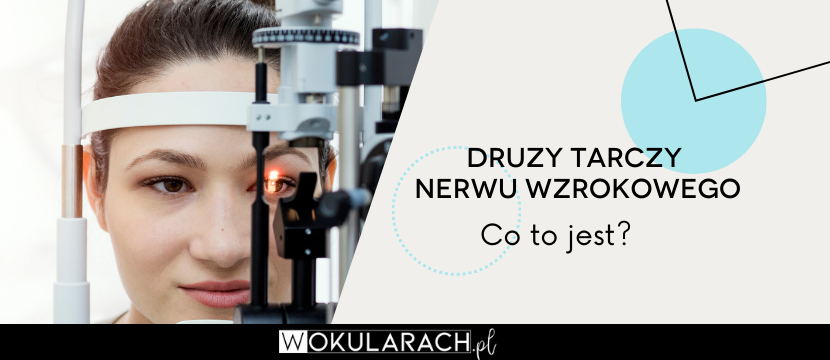 Druzy tarczy nerwu wzrokowego – co to jest?