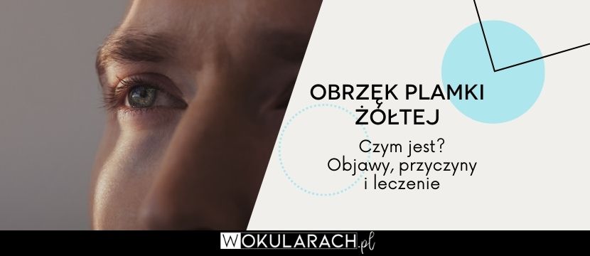 Obrzęk plamki żółtej – co to? Objawy, przyczyny i leczenie