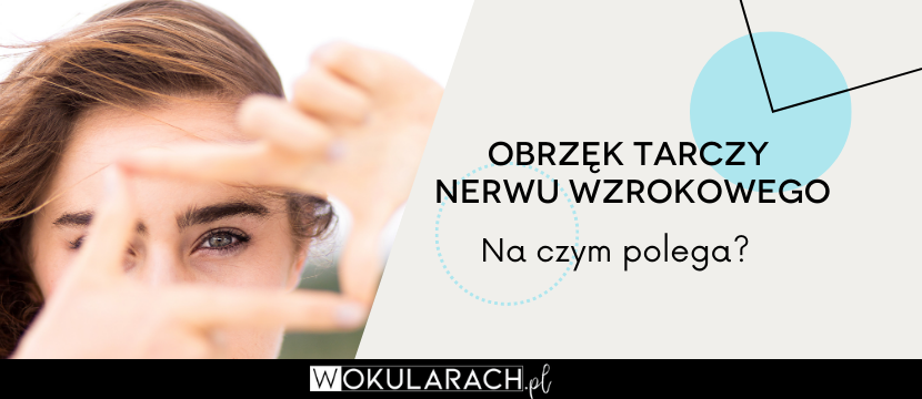 Obrzęk tarczy nerwu wzrokowego – na czym polega?