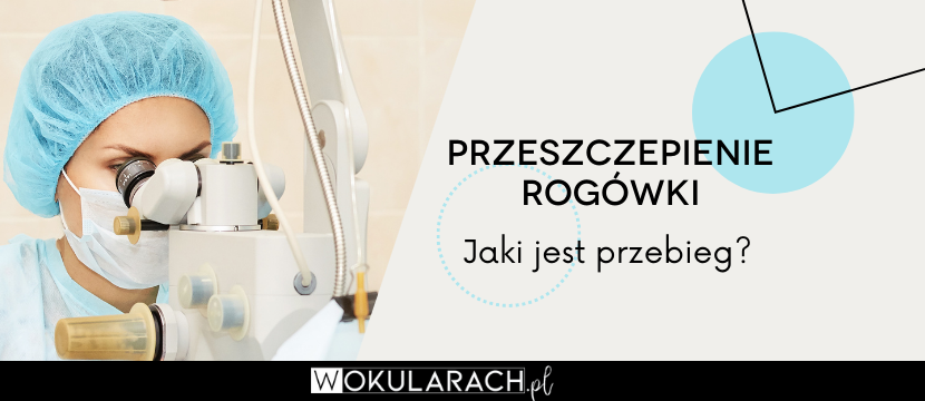 Przeszczepienie rogówki – jaki jest przebieg?