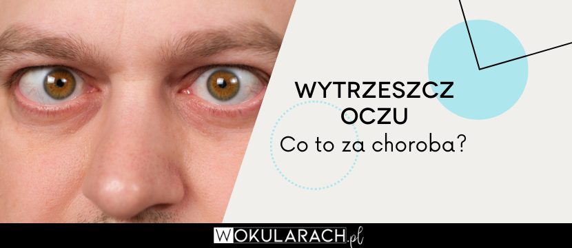 Wytrzeszcz oczu –  przyczyny, objawy i leczenie