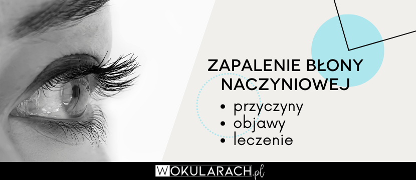 Zapalenie błony naczyniowej oka – przyczyny, objawy, leczenie