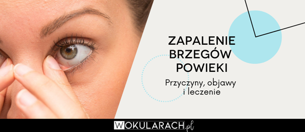 Zapalenie brzegów powiek - przyczyny, objawy i leczenie