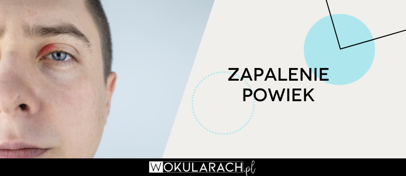 Zapalenie powiek