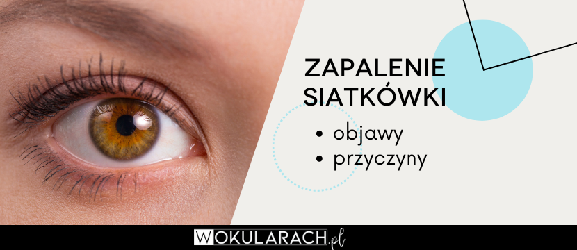 Zapalenie siatkówki – objawy i przyczyny