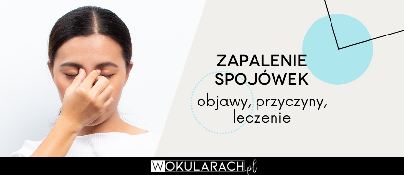 Zapalenie spojówek – objawy, przyczyny i leczenie