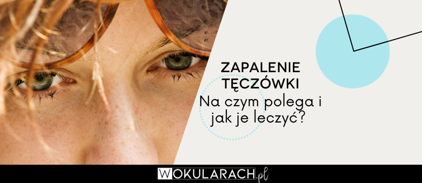 Zapalenie tęczówki – objawy, przyczyny i leczenie